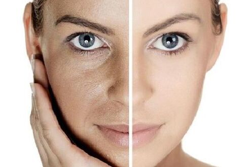 Faire la peau avec son propre plasma sanguin