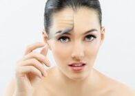 Fille après rajeunissement du visage au laser fractionné.