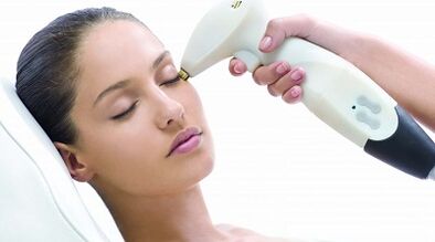 Comment se déroule le resurfaçage fractionné de la peau