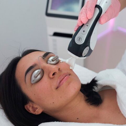 Traitement de la peau du visage au laser fractionné